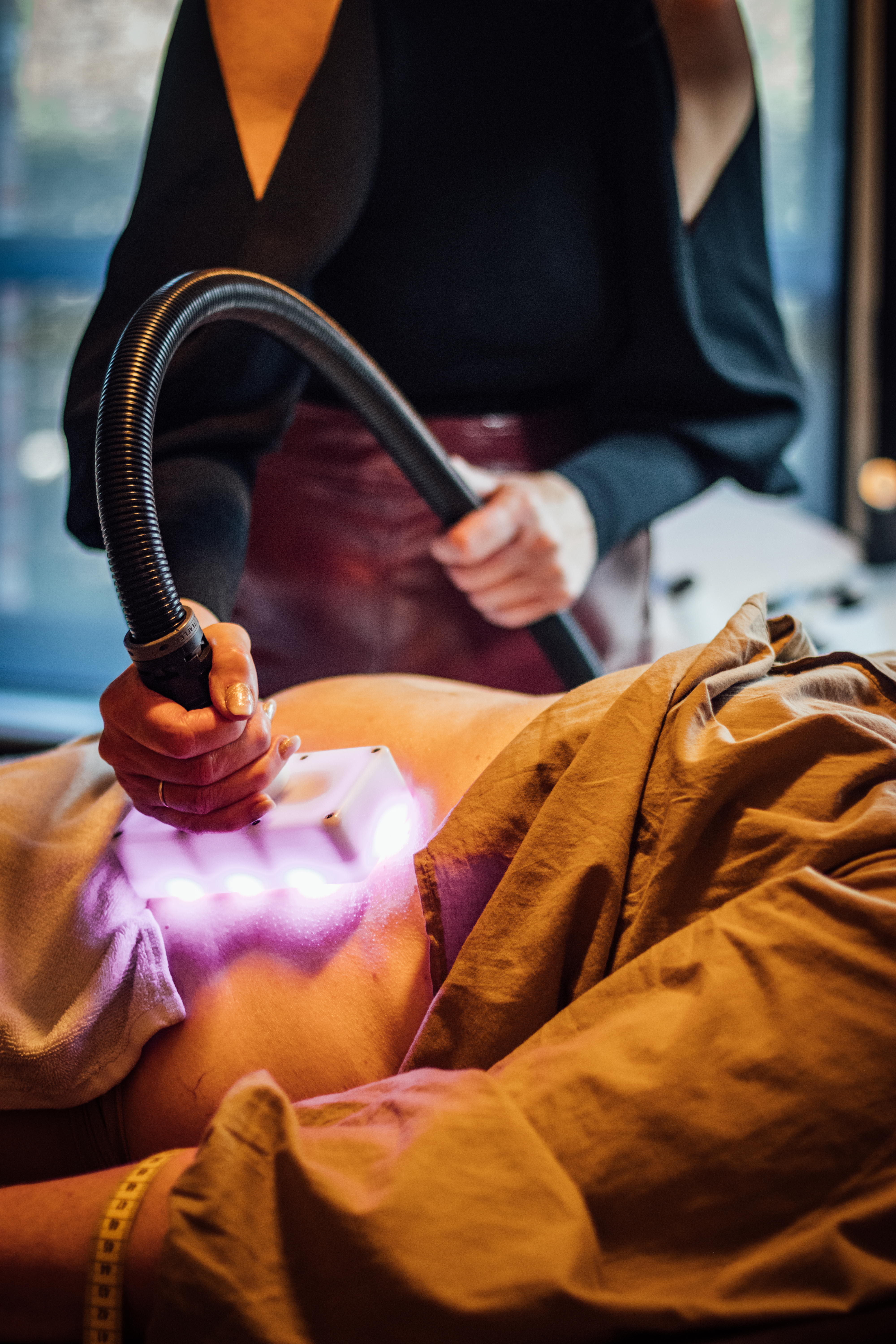 Cryotherapie behandeling met Cryo21 en Waves21